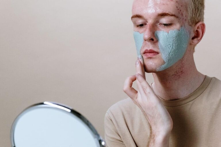 Maquillaje para Pieles con Acné: Consejos para Cuidar y Resaltar tu Piel